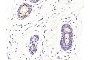 Immunohistochemical analysis of paraffin-embedded Human Normal breast section using Pink1 (ABIN1944795 and ABIN2838499).