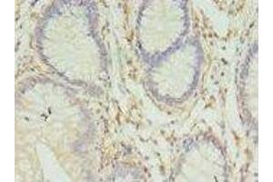 Immunohistochemistry (IHC) image for anti-Major Histocompatibility Complex, Class II, DR beta 4 (HLA-DRB4) (AA 30-227) antibody (ABIN6060855)