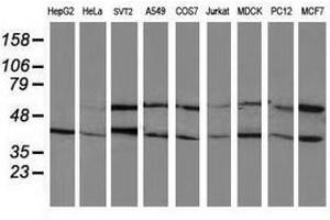 Image no. 2 for anti-Protein Phosphatase, Mg2+/Mn2+ Dependent, 1B (PPM1B) antibody (ABIN1500376) (PPM1B Antikörper)