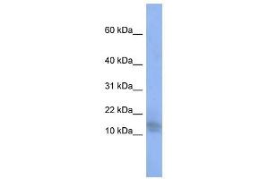 SPATA5 antibody used at 1 ug/ml to detect target protein. (SPATA5 Antikörper  (Middle Region))