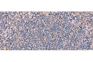 Immunohistochemistry of paraffin-embedded Human tonsil tissue using FDXR Polyclonal Antibody at dilution of 1:85(x200) (Ferredoxin Reductase Antikörper)