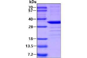 SDS-PAGE (SDS) image for Cytochrome B5 Reductase 2 (CYB5R2) (AA 1-276) protein (His tag) (ABIN5853701)