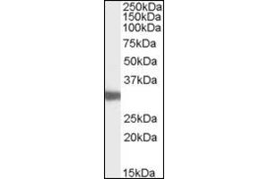 Image no. 1 for anti-Lactate Dehydrogenase C (LDHC) (AA 221-233), (Internal Region) antibody (ABIN374990) (Lactate Dehydrogenase C Antikörper  (Internal Region))