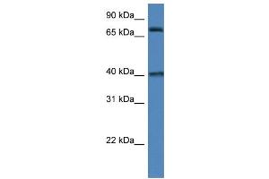 WB Suggested Anti-MPO AntibodyTitration: 1. (Myeloperoxidase Antikörper  (N-Term))