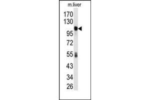 Image no. 1 for anti-Aldehyde Dehydrogenase 1 Family, Member L1 (ALDH1L1) (AA 724-754), (C-Term) antibody (ABIN360201)