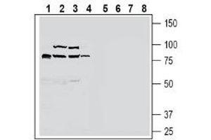 Western blot analysis of rat small intestine lysate (lanes 1 and 5), mouse liver lysate (lanes 2 and 6), rat liver lysate (lanes 3 and 7) and rat brain lysate (lanes 4 and 8): - 1-4. (SLC30A10 Antikörper  (C-Term, Intracellular))