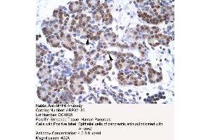 Human Pancreas (MYF6 Antikörper  (N-Term))