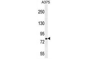 CB086 Antibody (C-term) western blot analysis in A375 cell line lysates (35µg/lane).