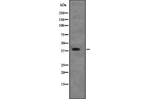 Western blot analysis of EIF2B2 expression in A431 whole cell lysate ,The lane on the left is treated with the antigen-specific peptide. (EIF2B2 Antikörper  (Internal Region))