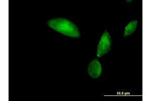 Immunofluorescence of purified MaxPab antibody to TMOD3 on HeLa cell. (TMOD3 Antikörper  (AA 1-352))