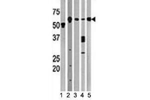 Western blot testing of Beclin antibody and (1) A2058, (2) HeLa, (3) mouse brain, (4) Y79, and (5) HL-60 lysate (Beclin 1 Antikörper  (AA 210-239))
