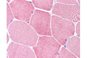 Anti-Caspase 6 antibody IHC of human skeletal muscle. (Caspase 6 Antikörper  (N-Term))