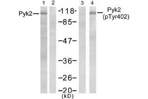 Western blot analysis of extract from Jurkat cells, untreated or treated with PMA (1ng/ml, 5min), using Pyk2 (Ab-402) antibody (E021209, Lane 1 and 2) and Pyk2 (phospho- Tyr402) antibody (E011216, Lane 3 and 4). (PTK2B Antikörper)