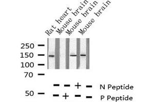 Western blot analysis of Phospho-Met (Tyr1349) expression in various lysates (c-MET Antikörper  (pTyr1349))