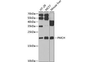 Western blot analysis of extracts of various cell lines, using PMCH antibody (ABIN6130564, ABIN6145812, ABIN6145813 and ABIN6222401) at 1:1000 dilution. (PMCH Antikörper  (AA 22-165))