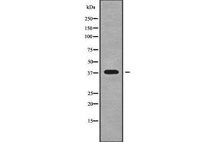 Western blot analysis NKX23 using RAW264. (NK2 Homeobox 3 Antikörper  (Internal Region))