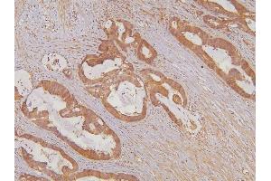 IHC analysis of KIF15 using anti-KIF15 antibody (ABIN6719385). (KIF15 Antikörper  (AA 1201-1388))