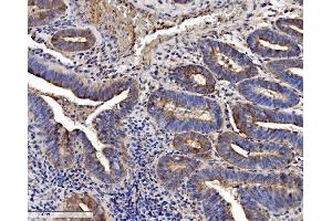 IHC analysis of SEC14L3/TAP2 using anti-SEC14L3/TAP2 antibody (ABIN7601623). (SEC14L3 Antikörper  (AA 4-400))
