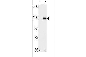 Western blot analysis of BUB1B (arrow) using rabbit polyclonal BUB1B Antibody (N-term) (ABIN392627 and ABIN2842137). (BUB1B Antikörper  (N-Term))