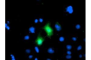 Anti-CDKN3 mouse monoclonal antibody (ABIN2455049) immunofluorescent staining of COS7 cells transiently transfected by pCMV6-ENTRY CDKN3 (RC213080). (CDKN3 Antikörper)
