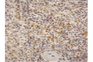 AP23688PU-N (2µg/ml) staining of paraffin embedded Human Spleen. (CYBB Antikörper  (Internal Region))