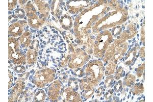 ADAMTS4 antibody was used for immunohistochemistry at a concentration of 4-8 ug/ml to stain Epithelial cells of renal tubule (arrows) in Human Kidney. (ADAMTS4 Antikörper  (N-Term))