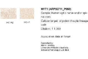 Sample Type: Human Optic Nerve and Spinal CordCellular Target: Oligoden Drocyte Lineage cellsDilution: 1:1000 (MYT1 Antikörper  (N-Term))