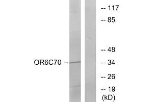 Western blot analysis of extracts from Jurkat cells, using OR6C70 antibody. (OR6C70 Antikörper  (C-Term))