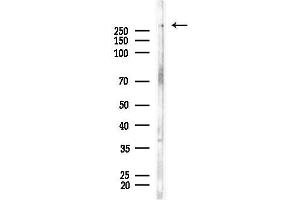 anti-Plectin (PLEC) (N-Term) antibody