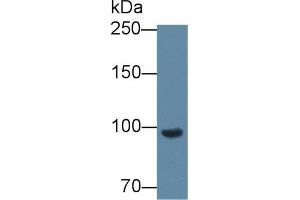 Western blot analysis of Mouse Blood Cells lysate, using Mouse CFB Antibody (2 µg/ml) and HRP-conjugated Goat Anti-Rabbit antibody ( (Complement Factor B Antikörper  (AA 474-590))