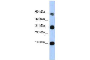 WB Suggested Anti-FABP4 Antibody Titration:  0. (FABP4 Antikörper  (Middle Region))
