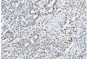 IHC analysis of CTBP2 using anti-CTBP2 antibody (ABIN7601325).