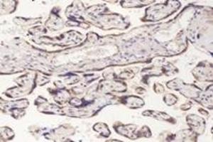 Immunohistochemistry analysis of paraffin-embedded human placenta using,PFDN4 (ABIN7075171) at dilution of 1: 4200 (PFDN4 Antikörper)
