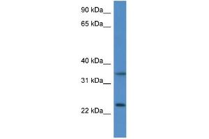 WB Suggested Anti-Cyb5r1 Antibody   Titration: 1. (CYB5R1 Antikörper  (N-Term))