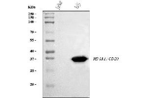 Western blot analysis of CD20 using anti-CD20 antibody (ABIN7599180). (CD20 Antikörper  (AA 1-261))
