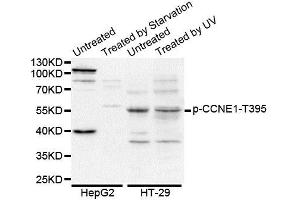 Western blot analysis of extracts of various cell lines, using Phospho-CCNE1-T395 antibody (ABIN5969875). (Cyclin E1 Antikörper  (pThr395))
