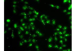 Immunofluorescence analysis of A549 cell using L3MBTL1 antibody.