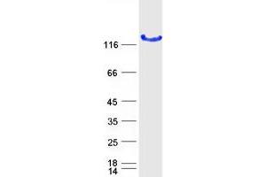 Validation with Western Blot (LRRC50 Protein (Myc-DYKDDDDK Tag))