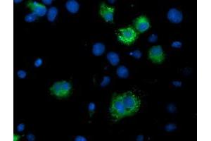 Immunofluorescence (IF) image for anti-IlvB (Bacterial Acetolactate Synthase)-Like (ILVBL) antibody (ABIN1498879) (ILVBL Antikörper)