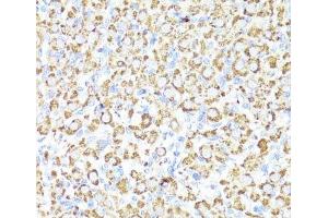 Immunohistochemistry of paraffin-embedded Rat ovary using CYP3A4 Polyclonal Antibody at dilution of 1:100 (40x lens). (CYP3A4 Antikörper)