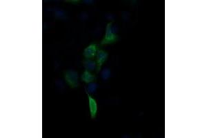 Image no. 2 for anti-Fibronectin Type III Domain Containing 4 (FNDC4) antibody (ABIN1498288)