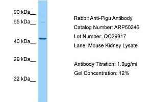 Western Blotting (WB) image for anti-Phosphatidylinositol Glycan Anchor Biosynthesis, Class U (PIGU) (N-Term) antibody (ABIN2784115)