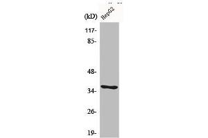 Western Blot analysis of LOVO cells using CA VI Polyclonal Antibody (CA6 Antikörper  (C-Term))