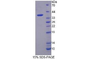 SDS-PAGE analysis of Human MDH2 Protein.