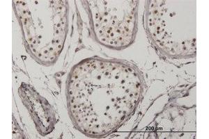 Image no. 3 for anti-Interferon Regulatory Factor 5 (IRF5) antibody (ABIN6745988) (IRF5 Antikörper)