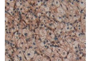 Immunohistochemistry (IHC) image for anti-Lectin, Galactoside-Binding, Soluble, 1 (LGALS1) (AA 1-135) antibody (ABIN7431629)