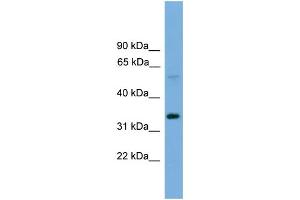 WB Suggested Anti-TM7SF4  Antibody Titration: 0.