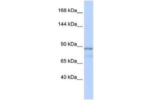 WB Suggested Anti-ZFAT1 Antibody Titration:  0. (ZFAT Antikörper  (Middle Region))