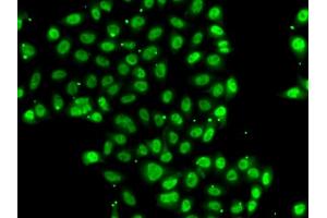 Immunofluorescence analysis of U2OS cells using ZNF148 antibody (ABIN5974210). (ZNF148 Antikörper)