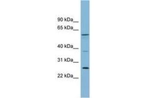 GDAP2 Antikörper  (AA 143-192)